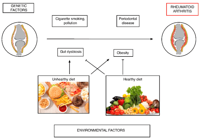 Zentrum der gesundheit arthrose ernährung